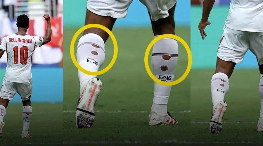 英格兰征战世界杯，怎么还给贝林厄姆穿了破洞袜子？